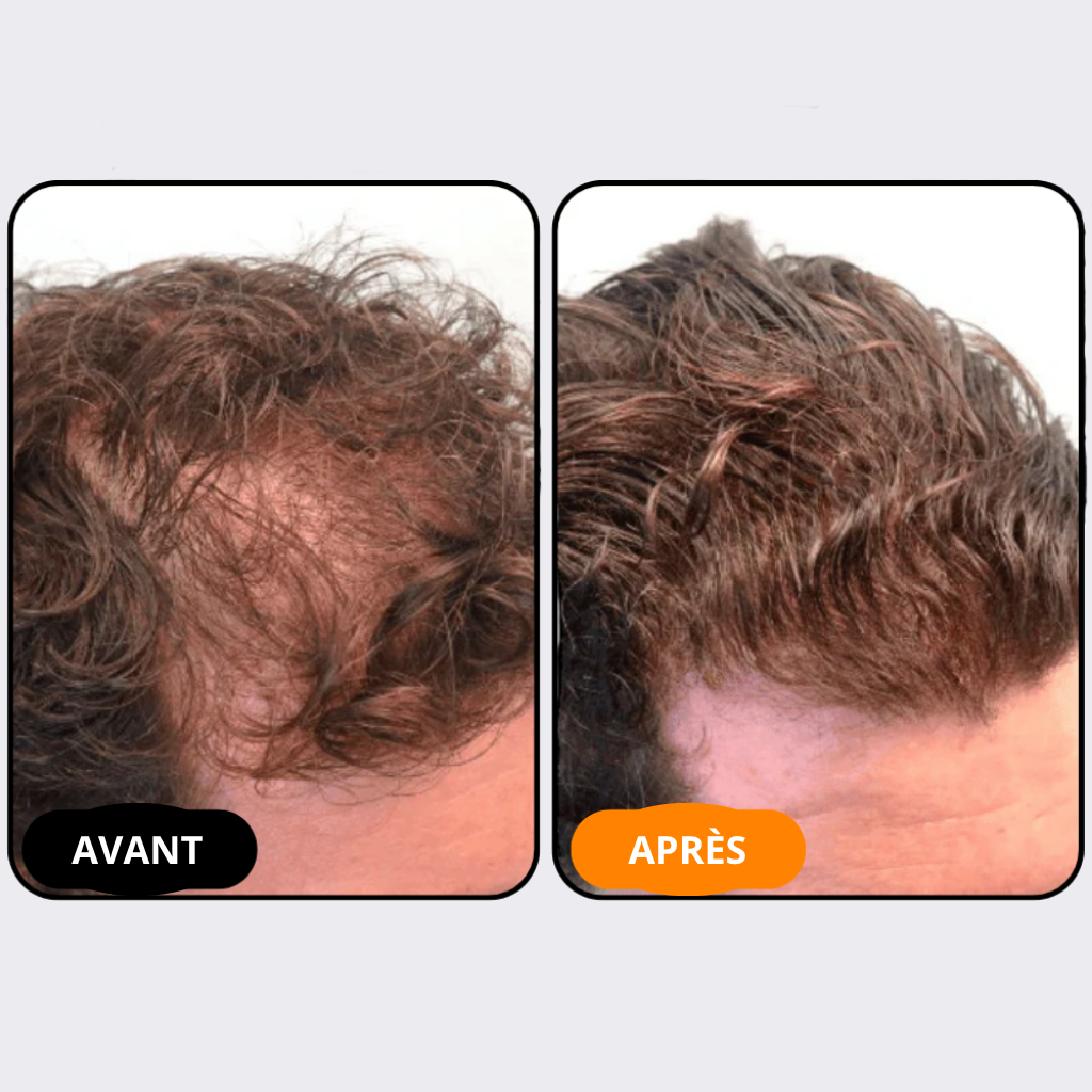 Shampooing activateur de racines