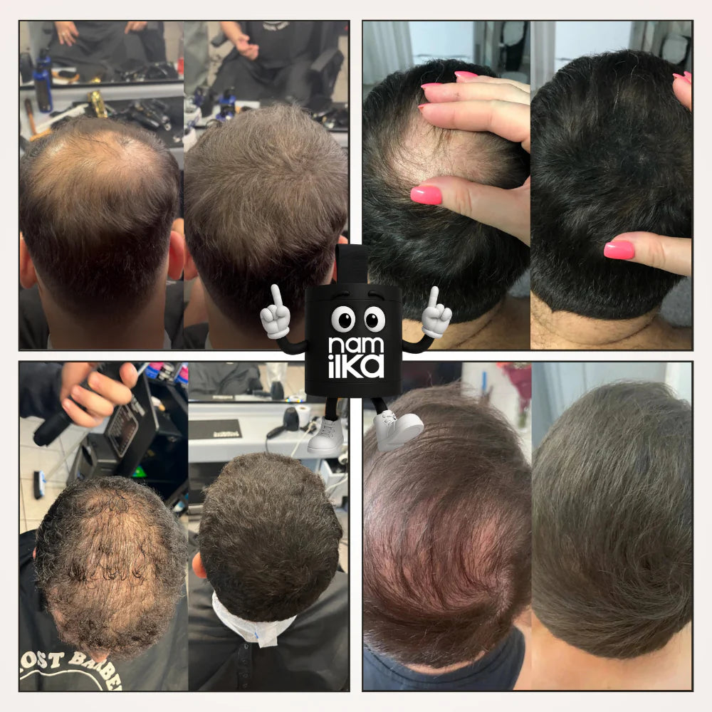 Camuffamento capelli - Namilka™